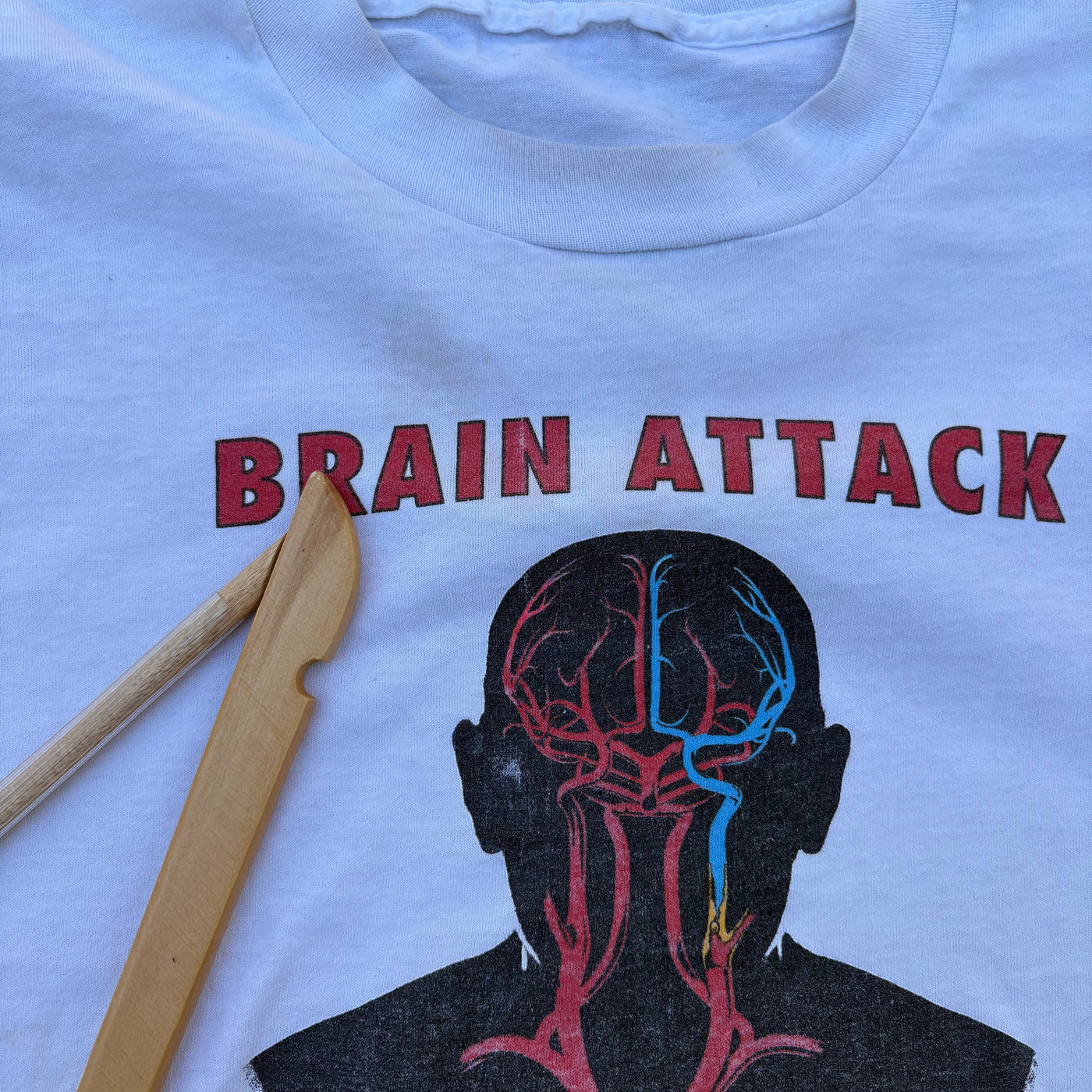 90s Brain Attack "Stroke Team"