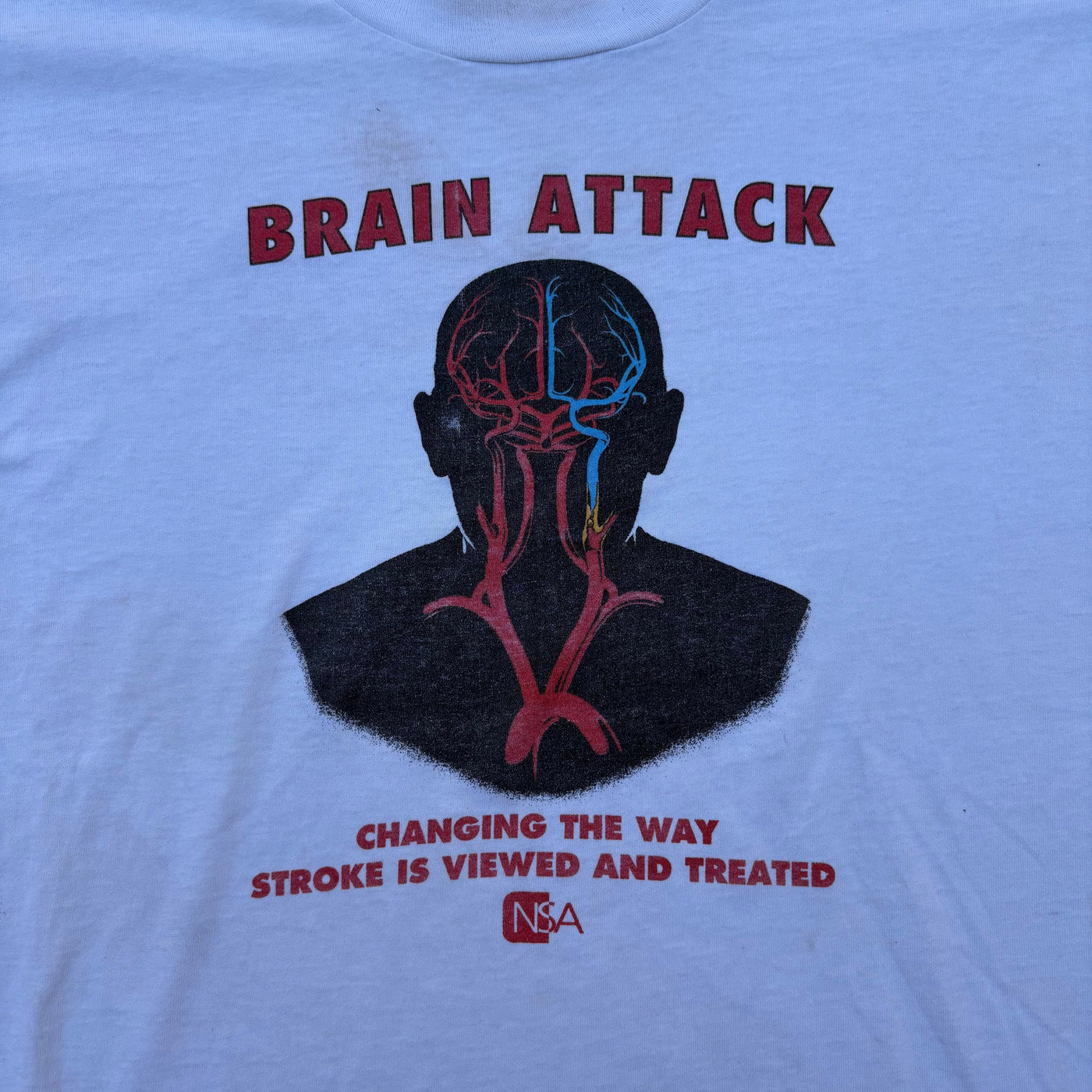 90s Brain Attack "Stroke Team"
